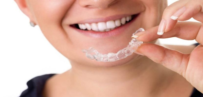Without Any Hesitation Make Use Of The Invisalign Braces To Treat Your Issues